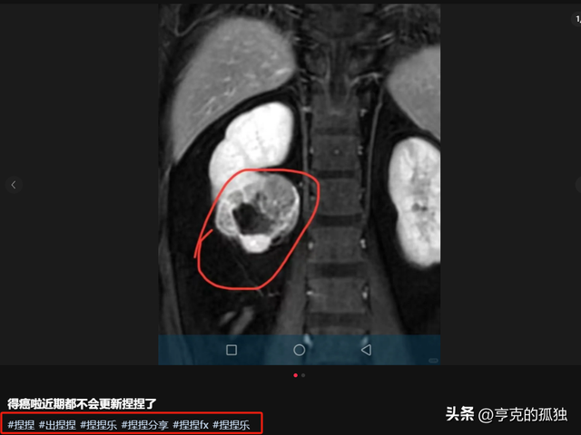 央视曝光！这些产品中全部检测出甲醛，严重可致癌，有人已中招