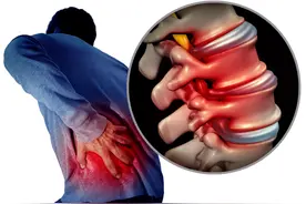 腰突，如果没有这5个症状，就可以把心放在肚子里图片