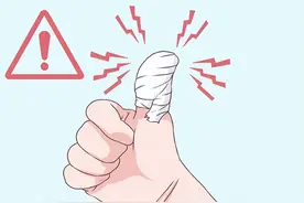 被它扎一下，有人截肢，有人住院！医生：春节期间高发，就在身边图片