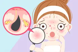 告别满面油光，科学控油有一招！教你如何减少油脂分泌图片