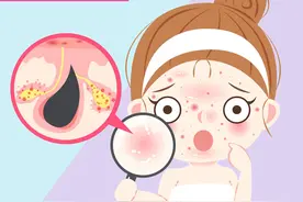 告别满面油光，科学控油有一招！教你如何减少油脂分泌图片