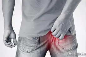 难以启齿的癌：9成肛门癌和HPV有关，早期症状要了解图片