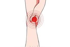 身体的这个部位竟是行走的“血糖仪”？图片
