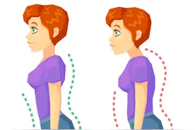 骨盆前倾3大原因！改善骨盆前倾症状和矫正运动一次看图片