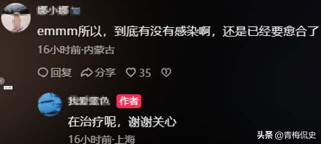 生理期潜水被鲨鱼咬伤后续：女子露面透细节，仍在感染中，已就医