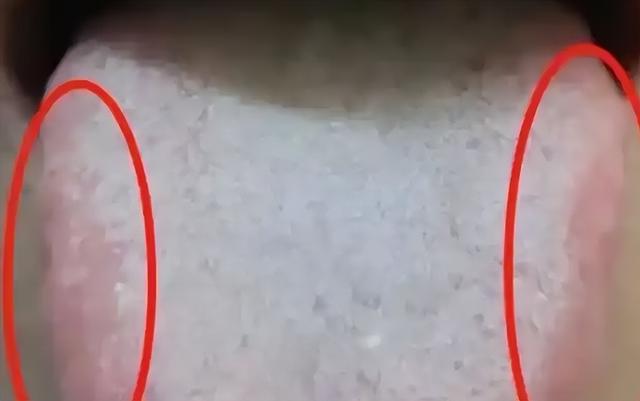 金锁固精丸vs锁阳固精丸：别吃错！2招分清，别踩这些坑！