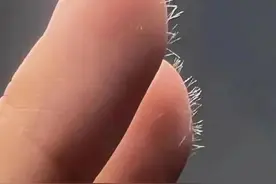 总扎手还找不到！手机、雨伞、钓鱼竿上竟都有隐形的“刺”图片