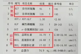 转氨酶升高不可怕，想要快速降酶，记住这3点！图片