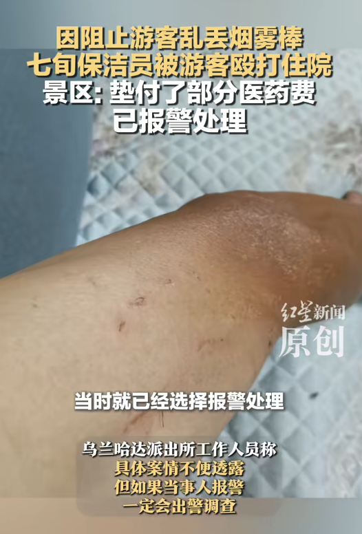 68岁保洁被游客群殴后续！伤情曝光是退伍老兵，警方介入网友炸锅