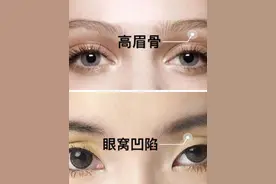 错把眼窝凹陷当欧式魅眼，你该注意了。图片