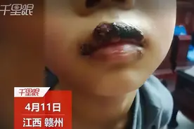 小学生放学嘴馋买五毛一包的辣条，吃完后嘴巴发紫起泡， 律师：家长可以向店家追责！图片