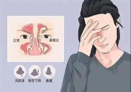 鼻内镜手术不可忽视的“要点”！