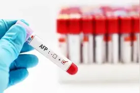 肝功能明明正常，却还是肝癌了，多是忽略了这三项指标图片