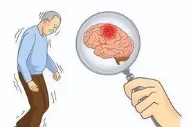 脑梗来临，睡觉先知？提醒：睡觉出现这6种异常，要警惕脑卒中！图片