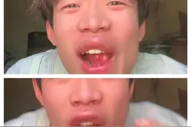 笑不活了！男子回家养蜂，被蜂蜇嘴唇！网友：蜜蜂真配合！图片