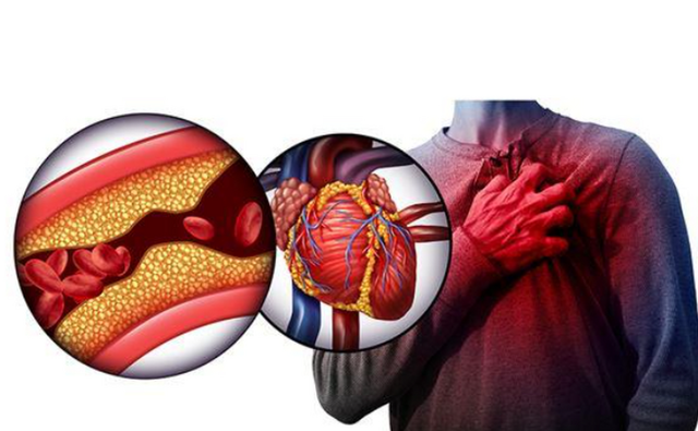 走路是长寿的良药！再次提醒：到了60岁，走路牢记“5不要”！