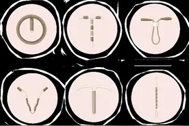 什么情况下应该“取环”？准备“取环”时，该注意些什么？图片