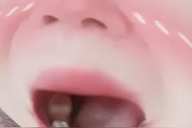 拔牙之后有一个空槽图片