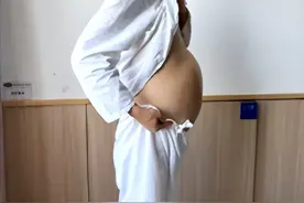 震惊！男子4个月没排便，腹中掏出2米长“蟒蛇肠”！图片