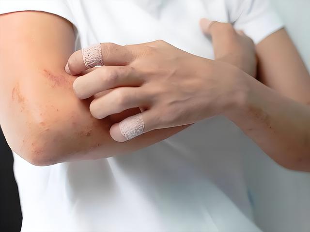 63岁男子皮肤瘙痒，以为是皮肤病	，体检后，医生叹：怎么不早来