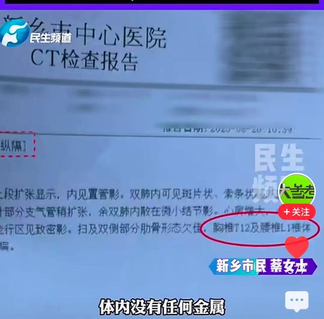 骨灰现四根钢钉后续：CT查无金属异物，监控视频是断续的！