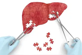 肝癌能活多久？有人活了几十年，有人不到半年，关键看这几点图片