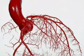 血管不是一天堵死的！这项检查能让"心脏堵车"提前限流图片