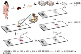 检查报告上经常出现的免疫组化是什么？一起来揭秘图片