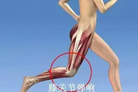 膝关节“弹响”，可能是这9大问题图片