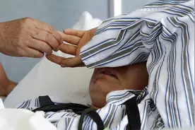 查出早期肝硬化，还能活10年吗？终于有人愿意说实话。图片