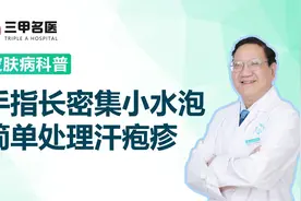 手指长密集小水泡特别痒，可能是汗疱疹，可以这样简单处理图片