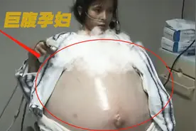 女人怀孕肚子狂飙100斤！丈夫以为是“怪物”，竟将妻子残忍抛弃图片