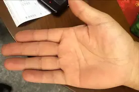 长不长寿，看手掌就知道？医生提醒：手掌出现这个异常一定多留意图片