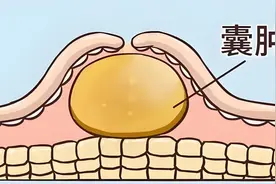 柴胡舒肝丸配一物，不仅能疏肝行气，还能活血化瘀，消散硬结！图片
