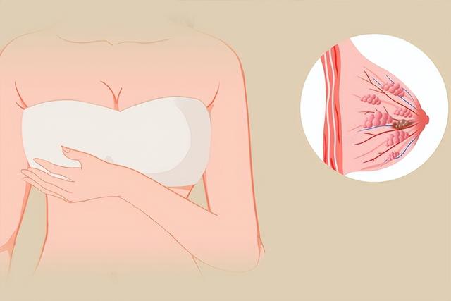 女生注意了！乳腺疼痛的几大常见原因，看完这篇就明白