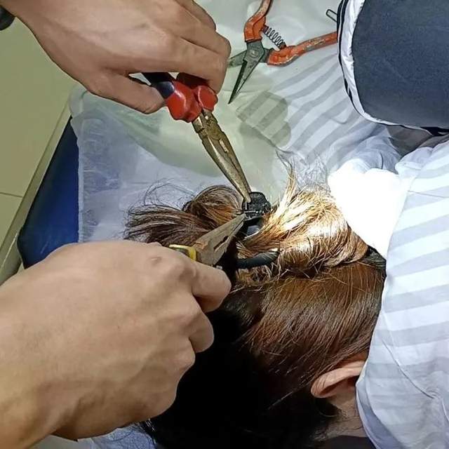 鲨鱼夹的使用 4d7e520f46de4575b7c599c553169ebf~tplv-tt-shrink:640:0.jpg?lk3s=06827d14&traceid=20240813084554F5E4C81AAEECAA01845B&x-expires=2147483647&x-signature=4NY0lvjAPp2iyyn7%2BcpkGuqj9oM%3D