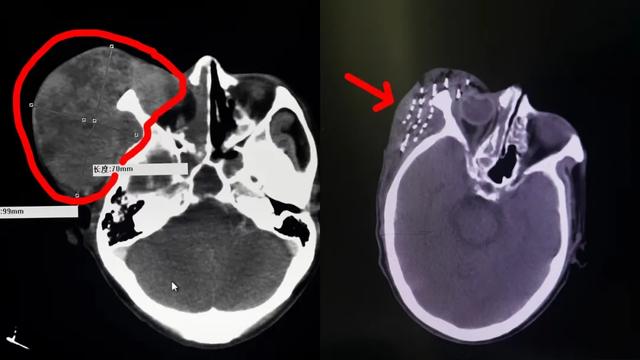 致肿瘤患者的一封信:癌症晚期,我的路怎么走?
