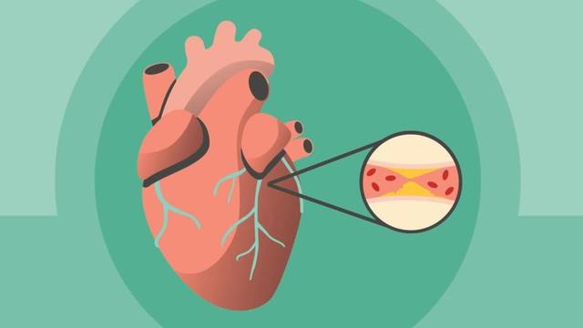 人有没有心梗，散步就知道？得心梗的人，散步常有这5个表现
