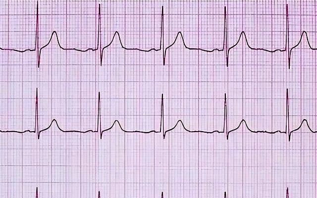 “经常运动”被推翻？医生建议：过了55岁，最好保持7个锻炼习惯