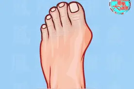 留意！双脚出现这5个表现，可能被一种“治不好”的疾病盯上了！图片
