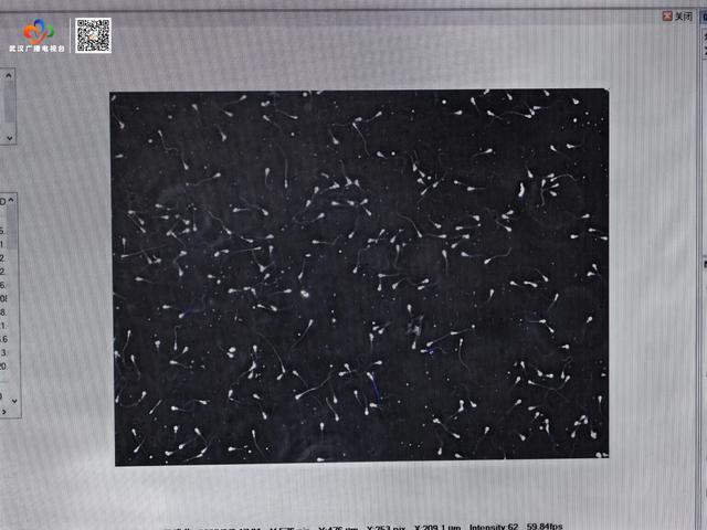 全球首个！这个精子库，今天在武汉建立