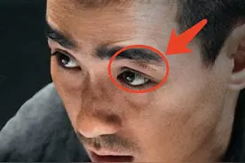 朱一龙伤情曝光，知情人透露伤情严重，第一时间送往香港医治图片