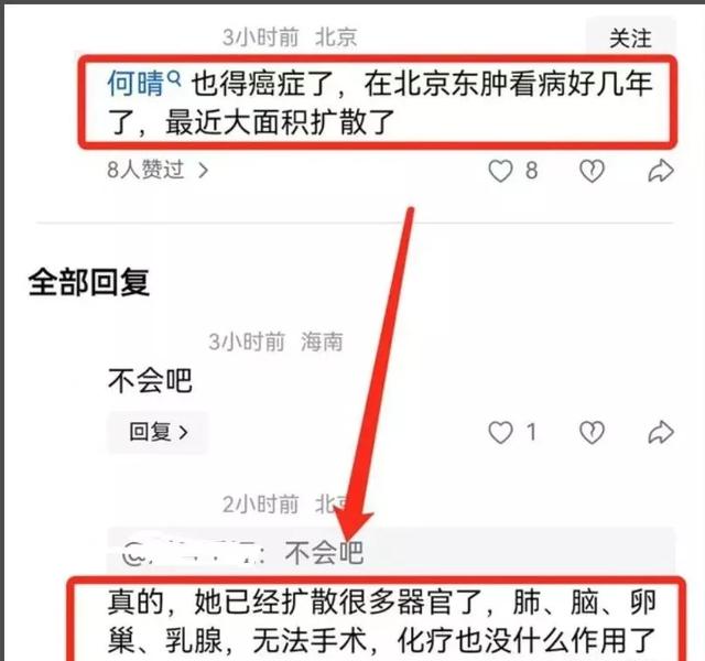 何晴离世年仅61岁！生前因脑瘤淡出娱乐圈，后患癌恶化无法手术
