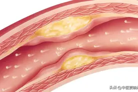 一个中成药，心阳足了，瘀血化了，心就舒适了，远离心脑血管疾病图片