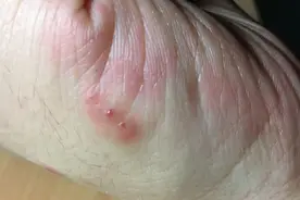 脚的大小影响寿命长短？脚越大，命越短？真的吗？听听医生怎么说图片