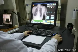 48岁肺结节9毫米，术后总费用超过7万，病理都是微浸润腺癌图片