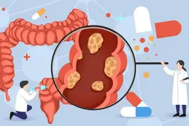 做着肠镜，还要交麻醉、切息肉、还有病理费？咋这么高图片