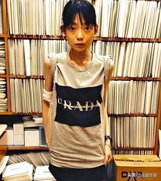 一代女神沦为豪门玩物？结婚8年牙齿全掉，器官切除，面似骷髅