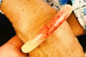 邻居老奶奶戴了70多年的玉镯子长红血丝了，到底是什么原因？图片