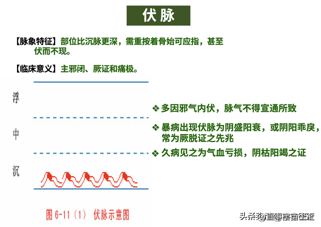 中诊入门：浮、散、革、芤脉，沉脉对比伏、牢脉，文末附《指法》